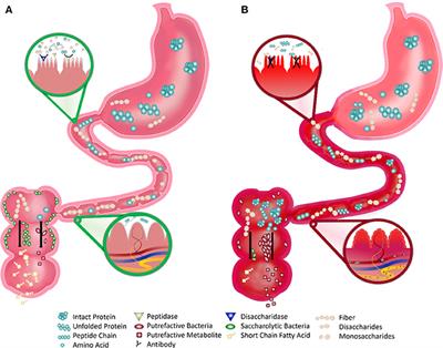 Dietary Considerations in Autism Spectrum Disorders: The Potential Role of Protein Digestion and Microbial Putrefaction in the Gut-Brain Axis